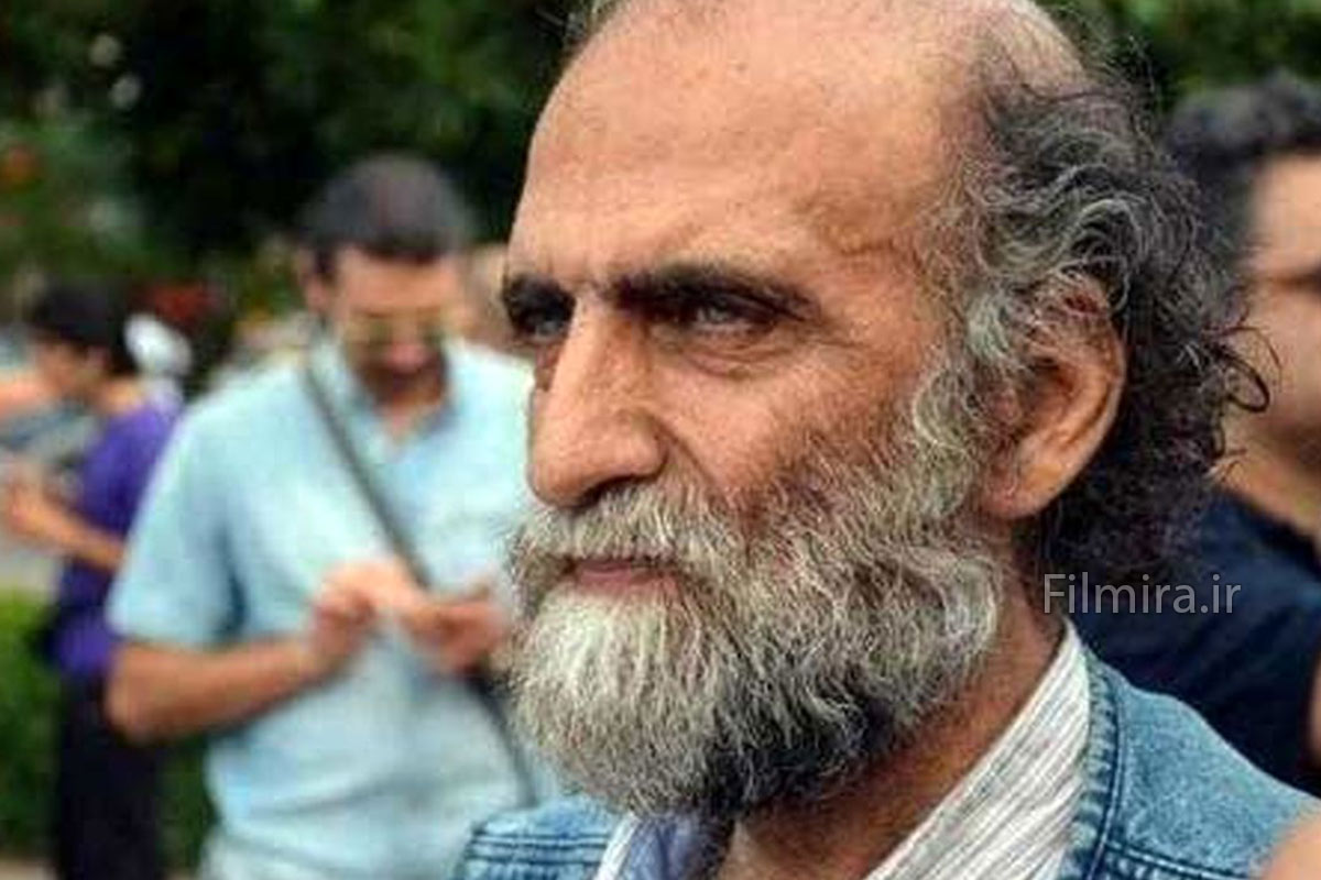 بازیگر صورت زخمی در سریال بچه مهندس 1